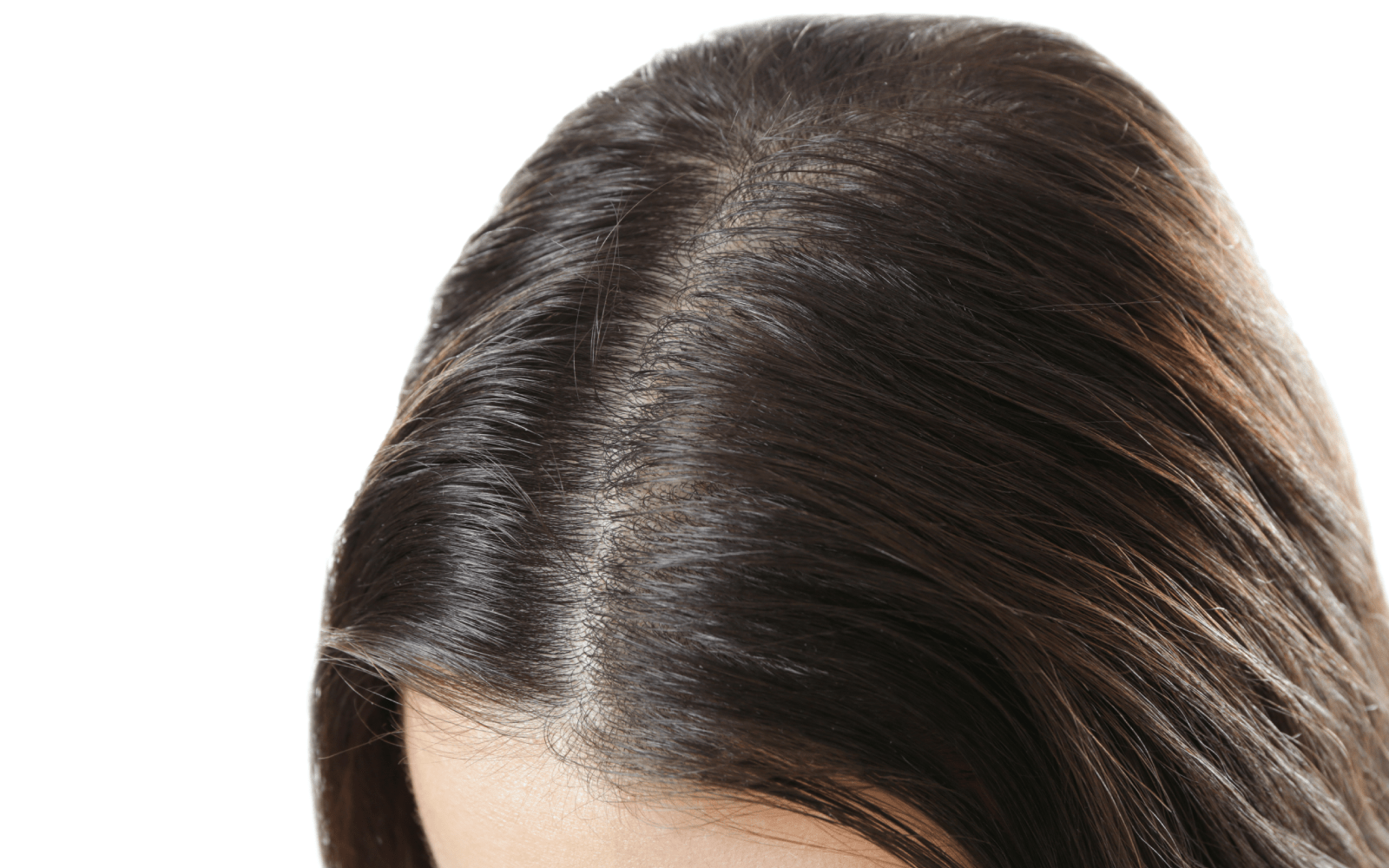 Toppers and Hair Replacement